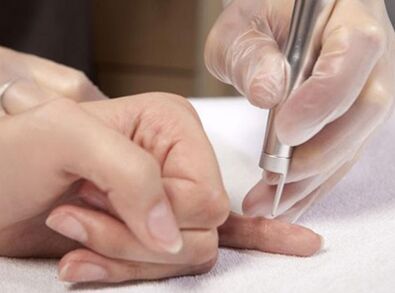 Vedenie laserovej terapie