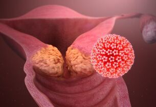 aké choroby spôsobujú HPV